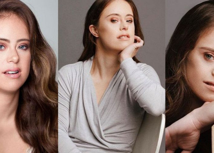 ΠΡΩΤΑΘΛΗΤΡΙΑ ΕΝΟΡΓΑΝΗΣ ΜΕ ΣΥΝΔΡΟΜΟ DOWN ΓΙΝΕΤΑΙ ΜΟΝΤΕΛΟ ΚΑΙ ΕΜΠΝΕΕΙ ΚΑΘΕ ΓΥΝΑΙΚΑ!