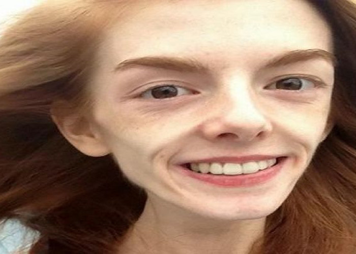 ΕΚΠΛΗΚΤΙΚΗ ΜΕΤΑΜΟΡΦΩΣΗ: ΑΝΟΡΕΞΙΚΗ ΠΟΥ ΖΥΓΙΖΕ 30 ΚΙΛΑ ΣΩΘΗΚΕ ΑΠΟ ΤΗ ΣΟΚΟΛΑΤΑ!