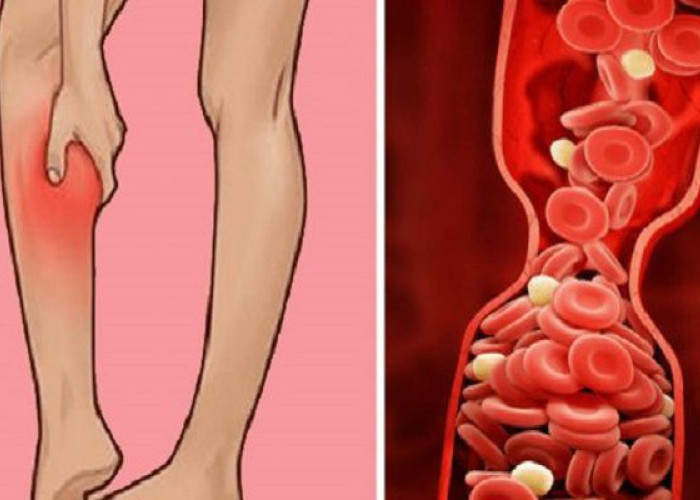 ΟΤΙ ΠΡΕΠΕΙ ΝΑ ΞΕΡΕΤΕ ΓΙΑ ΤΙΣ ΘΡΟΜΒΩΣΕΙΣ ΚΑΙ ΠΩΣ ΝΑ ΤΙΣ ΑΝΤΙΜΕΤΩΠΙΣΕΤΕ!