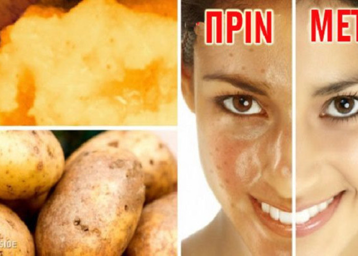 8 ΤΡΟΦΕΣ ΠΟΥ ΚΑΝΟΥΝ ΚΑΛΟ ΣΤΟ ΔΕΡΜΑ ΣΑΣ!