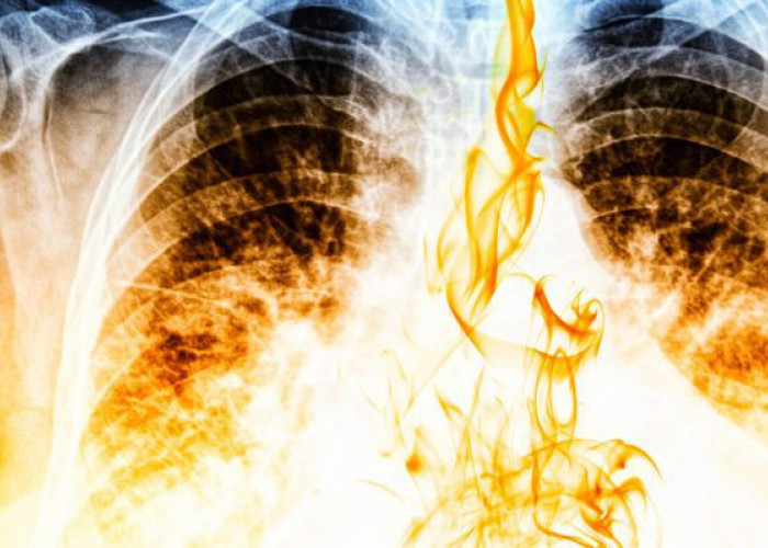 Σε πόσο καιρό θα καθαρίσουν οι πνεύμονες, αν κόψετε σήμερα το κάπνισμα!!!