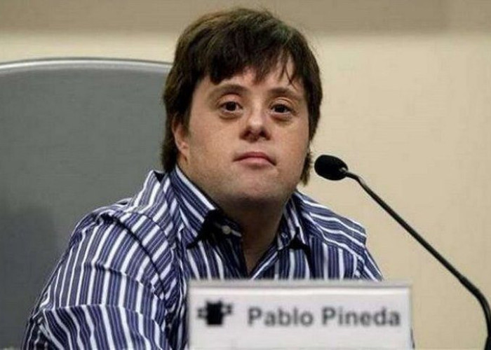 Ο πρώτος πτυχιούχος Πανεπιστημίου με σύνδρομο Down, μιλάει για την «καθυστερημένη» κοινωνία