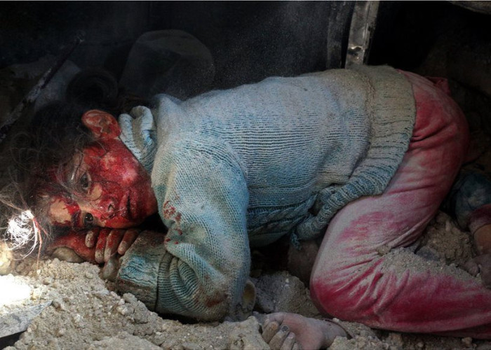 Συγκλονιστική φωτογραφία από την Συρία: Κoριτσάκι περιμένει να σωθεί δίπλα στη νεκρή αδερφούλα του