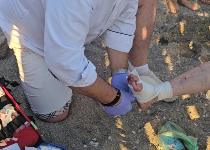 Σοβαρός τραυματισμός γυναίκας από επίθεση θαλάσσιας χελώνας - Δάγκωσε άλλους δύο λουόμενους