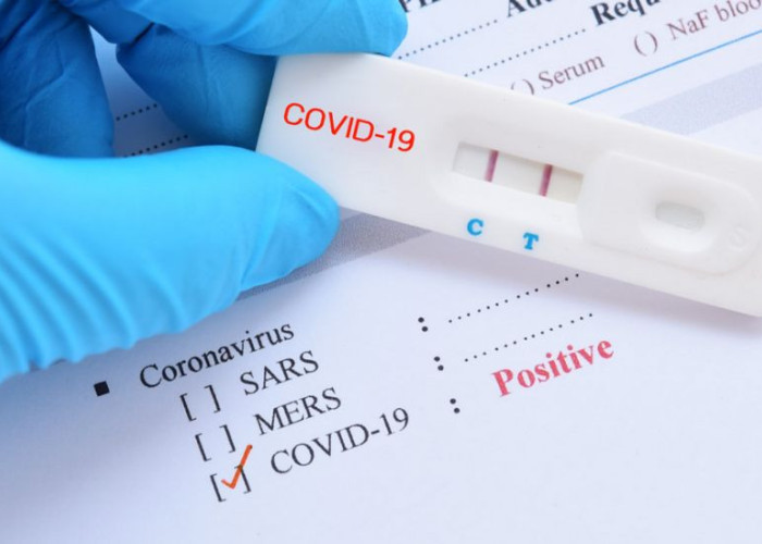 ΕΟΔΥ: Δύο σοβαρά κρούσματα γρίπης σε μία εβδομάδα – Αυξήθηκαν οι μολύνσεις από κορονοϊό