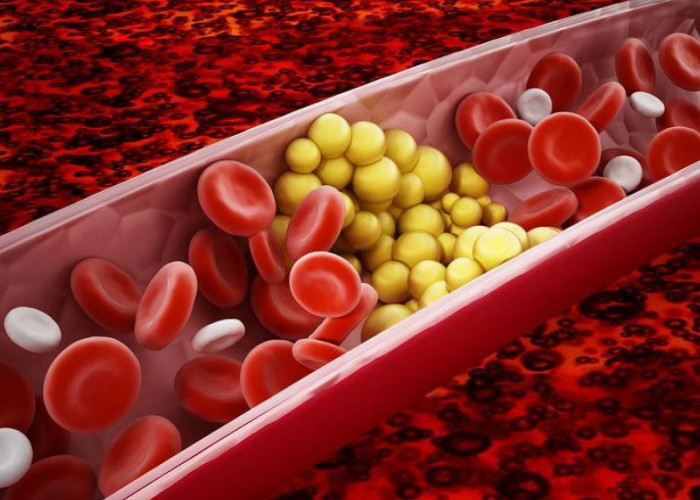 Το πρώτο βήμα για χαμηλότερη χοληστερίνη: Τι προτείνουν οι καρδιολόγοι