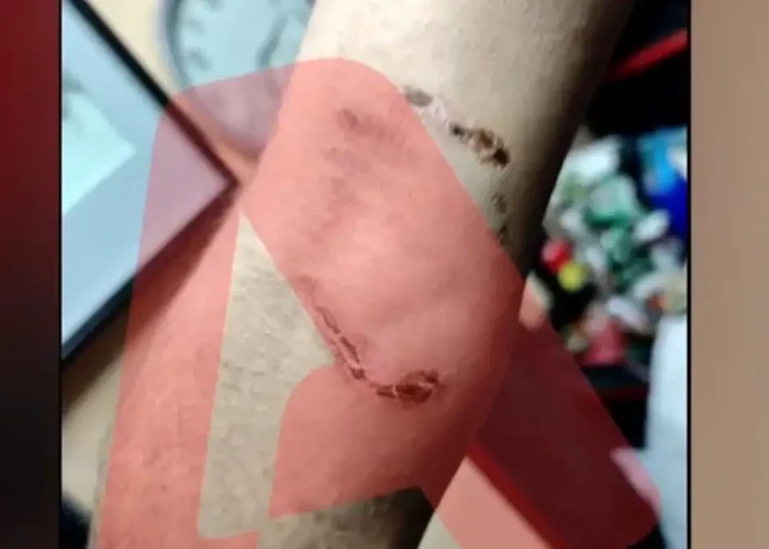 Ομόνοια: Νεαρός έβαλε το πίτμπουλ του να επιτεθεί σε 30χρονο για να τον ληστέψει – «Με έριξε κάτω και το σκυλί με δάγκωνε»