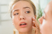 Τροφικές δυσανεξίες: Αυτό το σημάδι στο πρόσωπο ίσως δείχνει πρόβλημα με αυτά που τρώτε.