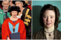 KOΠΕΛΑ ΓΕΝΝΗΘΗΚΕ ΜΕ ΣΥΝΔΡΟΜΟ DOWN, AΠΟΦΟΙΤΗΣΕ ΑΠΟ ΤΗ ΝΟΜΙΚΗ ΚΑΙ ΣΤΕΛΝΕΙ ΤΟ ΠΙΟ ΔΥΝΑΤΟ ΜΗΝΥΜΑ ΕΛΠΙΔΑΣ!