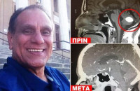 ANΤΡΑΣ ΜΕ ΚΑΡΚΙΝΟ «ΚΕΡΔΙΣΕ» ΤΟΝ ΟΓΚΟ ΣΤΟ ΚΕΦΑΛΙ ΜΕ ΠΡΟΣΕΥΧΗ ΣΤΟ ΘΕΟ ΚΑΙ ΟΙ ΓΙΑΤΡΟΙ «ΣΚΙΖΟΥΝ ΤΑ ΠΤΥΧΙΑ ΤΟΥΣ»