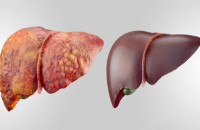 ΚΑΘΑΡΙΣΤΕ ΤΟ ΣΥΚΩΤΙ ΣΑΣ ΜΕ 6 ΦΥΣΙΚΟΥΣ ΚΑΙ ΑΝΩΔΥΝΟΥΣ ΤΡΟΠΟΥΣ-ΣΩΖΕΙ ΖΩΕΣ!