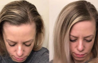 Τέλος στα λαδωμένα μαλλιά χωρίς λούσιμο: Το «μαγικό» υλικό από το ντουλάπι της κουζίνας που θα σας σώσει