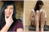 Αθηναΐς Νέγκα: «Πήρα τη λεύκη μου για ποτό στην Άνω Σύρο» – Ένα δυνατό μήνυμα προς όλους πως πρέπει να αγαπάμε το σώμα μας.