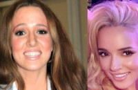 Κατάξανθη, με νέα μύτη και χείλη: Την Καλομοίρα τρόμαξαν να την γνωρίσουν οι θαυμαστές της