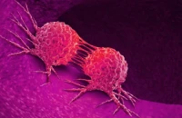 Ο καρκίνος σε ηλικίες κάτω των 50 έχει αυξηθεί κατά 80%