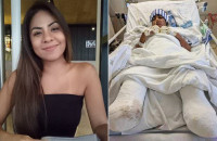 «Όταν Άνοιξα Τα Μάτια Μου, Δεν Είχα Πόδια Και Δάχτυλα Στα Χέρια. Κάτι Τόσο Απλό, Μου Κατέστρεψε Τη Ζωή»