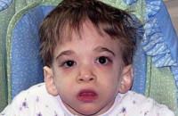 Η Ασθένεια Του Έχει Σοκάρει Τους Γιατρούς Παγκοσμίως. Μόλις Μάθετε ΠΟΣΟ Χρονών Είναι, Θα Σας Πέσει Το Σαγόνι!