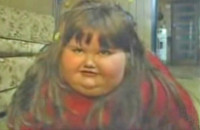 Η μεταμόρφωση της 8χρονης που ζύγιζε 190 κιλά