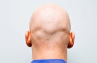 Γιατί χάνουμε τα μαλλιά μας περισσότερο μέσα στις γιορτές των Χριστουγέννων;