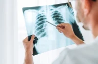 Τραγωδία στο Ηράκλειο: Καρκινοπαθής αυτοκτόνησε περιμένοντας φάρμακο – Δεν άντεχε τους πόνους