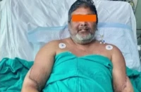 Ινδία: Άνδρας έχει πλέον γυναικεία χέρια ύστερα από σπάνια διπλή μεταμόσχευση Ινδία: Άνδρας έχει πλέον γυναικεία χέρια ύστερα από σπάνια διπλή μεταμόσχευση