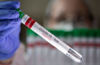 Κορονοϊός: Αυτό είναι το τεστ που θα κάνουμε στο σπίτι