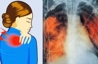 5 πόνοι στο σώμα που δεν πρέπει ποτέ να αγνοήσεις, τι σημαίνουν για την υγεία σου και τι πρέπει να κάνεις