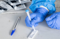 Δήμος Σερρών: Δωρεάν μαζικά rapid tests την εβδομάδα (4-6/10/21)