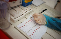 Όμικρον – Γιατί το rapid test βγαίνει αρνητικό στον κοροναϊό και το PCR θετικό;