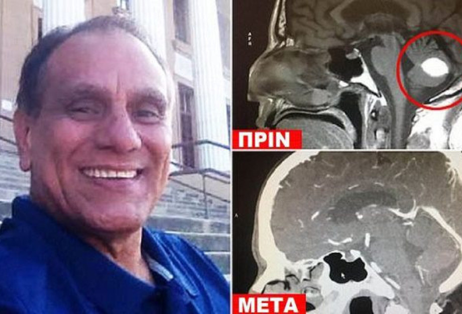 ANΤΡΑΣ ΜΕ ΚΑΡΚΙΝΟ «ΚΕΡΔΙΣΕ» ΤΟΝ ΟΓΚΟ ΣΤΟ ΚΕΦΑΛΙ ΜΕ ΠΡΟΣΕΥΧΗ ΣΤΟ ΘΕΟ ΚΑΙ ΟΙ ΓΙΑΤΡΟΙ «ΣΚΙΖΟΥΝ ΤΑ ΠΤΥΧΙΑ ΤΟΥΣ» ANΤΡΑΣ ΜΕ ΚΑΡΚΙΝΟ «ΚΕΡΔΙΣΕ» ΤΟΝ ΟΓΚΟ ΣΤΟ ΚΕΦΑΛΙ ΜΕ ΠΡΟΣΕΥΧΗ ΣΤΟ ΘΕΟ ΚΑΙ ΟΙ ΓΙΑΤΡΟΙ «ΣΚΙΖΟΥΝ ΤΑ ΠΤΥΧΙΑ ΤΟΥΣ»