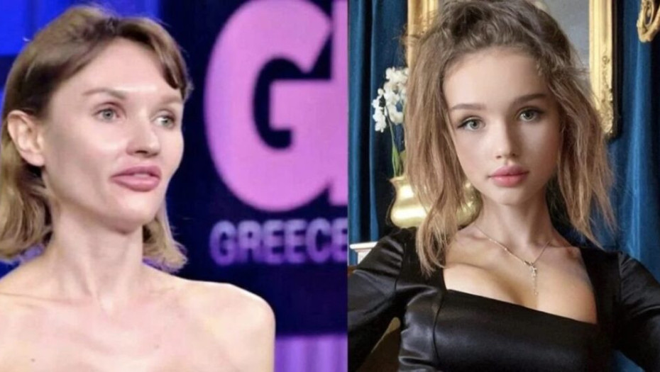 Συνέχισε τις πλαστικές, μοιάζει πλέον 16χρονη Barbie: Αγνώριστη η υποψήφια του GNTM που την απέρριψαν λόγω ηλικίας