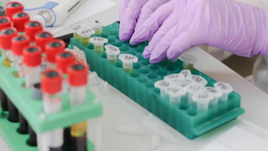 Φάρμακο εξάλειψε τον καρκίνο του παχέος εντέρου σύμφωνα νέα με μελέτη!