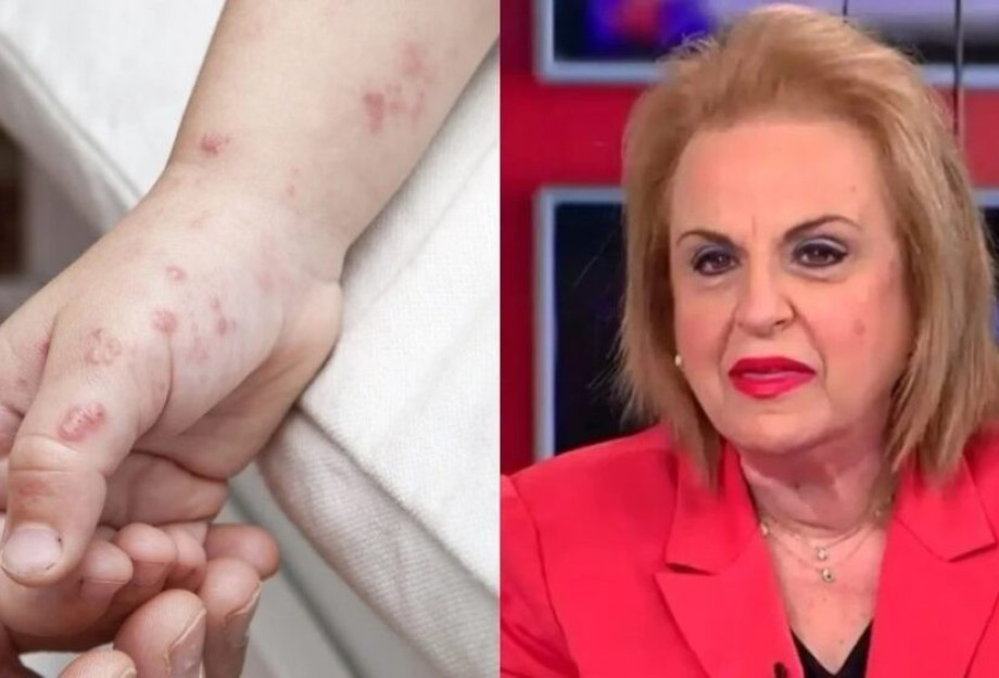 «Ο ιός θα εξαπλωθεί καλοκαίρι»: Σuvαγεpμός για την Ευλογιά των πιθήκων – Τι προκαλεί και πώς κολλάει «Ο ιός θα εξαπλωθεί καλοκαίρι»: Σuvαγεpμός για την Ευλογιά των πιθήκων – Τι προκαλεί και πώς κολλάει