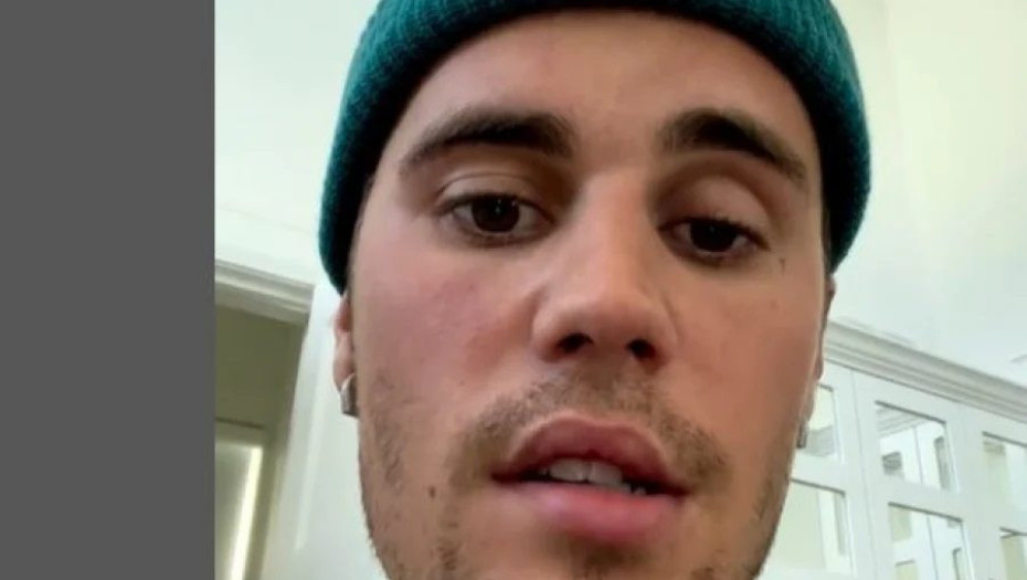 Παρέλυσε το πρόσωπο του Τζάστιν Μπίμπερ: Tι είναι το σύνδρομο Ramsay Hunt (βίντεο)