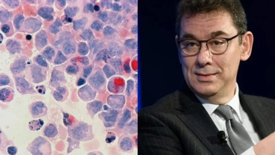 Είμαστε κοντά στον στόχο της θεραπείας του καρκίνου – Το είπε ο Μπουρλά