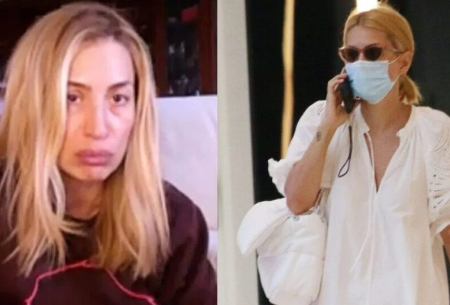 «Η Παναγία βοήθησε για ακόμη μία φορά»: Ατύχημα για την παρουσιάστρια Μαρία Ηλιάκη, τα 4 ράμματα στο χέρι «Η Παναγία βοήθησε για ακόμη μία φορά»: Ατύχημα για την παρουσιάστρια Μαρία Ηλιάκη, τα 4 ράμματα στο χέρι