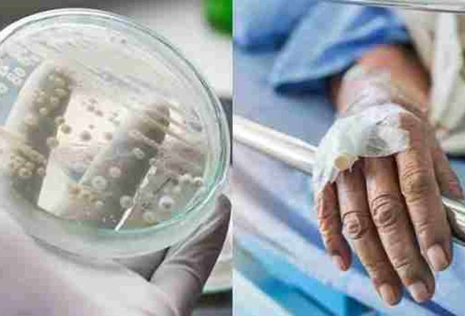Candida Auris: Τι συμβαίνει με τη διασπορά του μύκητα στα νοσοκομεία – Τι λέει ο Σύψας