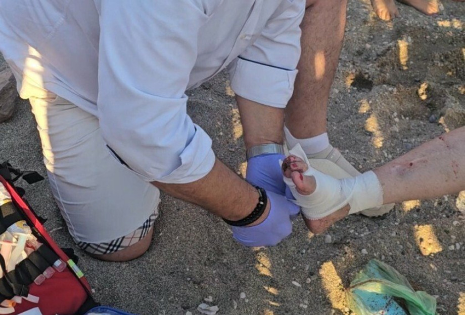 Σοβαρός τραυματισμός γυναίκας από επίθεση θαλάσσιας χελώνας - Δάγκωσε άλλους δύο λουόμενους