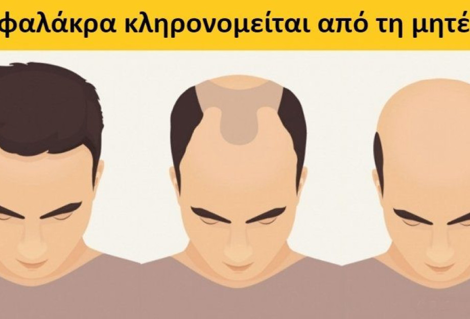 10 προσωπικά χαρακτηριστικά που δεν γνωρίζαμε ότι κληρονομούνται από τους γονείς μας 10 προσωπικά χαρακτηριστικά που δεν γνωρίζαμε ότι κληρονομούνται από τους γονείς μας