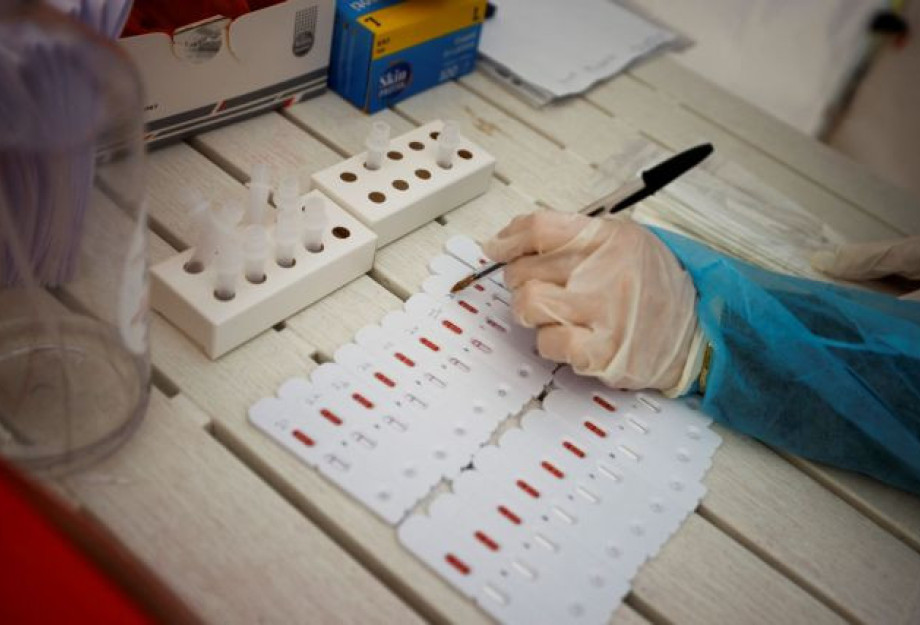 Όμικρον – Γιατί το rapid test βγαίνει αρνητικό στον κοροναϊό και το PCR θετικό; Όμικρον – Γιατί το rapid test βγαίνει αρνητικό στον κοροναϊό και το PCR θετικό;