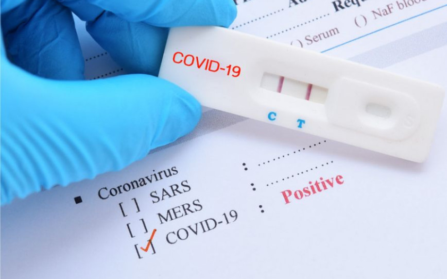 ΕΟΔΥ: Δύο σοβαρά κρούσματα γρίπης σε μία εβδομάδα – Αυξήθηκαν οι μολύνσεις από κορονοϊό