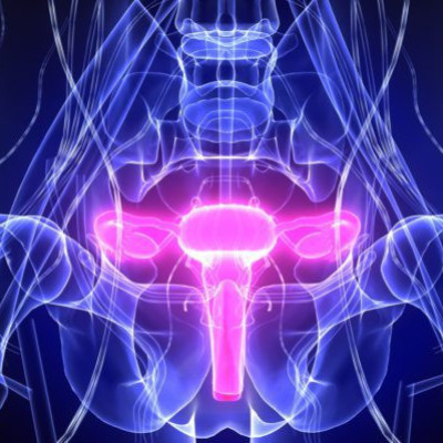 ΚΑΡΚΙΝΟΣ ΤΟΥ ΤΡΑΧΗΛΟΥ ΤΗΣ ΜΗΤΡΑΣ: ΤΑ ΣΗΜΑΔΙΑ ΟΤΙ Η ΘΑΝΑΤΗΦΟΡΑ ΑΣΘΕΝΕΙΑ ΕΧΕΙ ΠΡΟΧΩΡΗΣΕΙ!