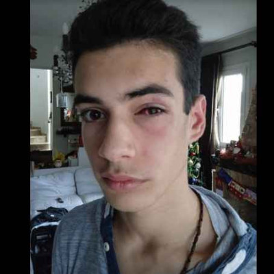 Ξυλοδαρμός 15χρονου στη Χαλκιδική – Η ανάρτηση της μητέρας του