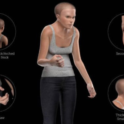 Έτσι θα είναι άνθρωπος του 3.000 μ. Χ.: Με κύφωση, συρρικνωμένο λαιμό και… διπλά βλέφαρα