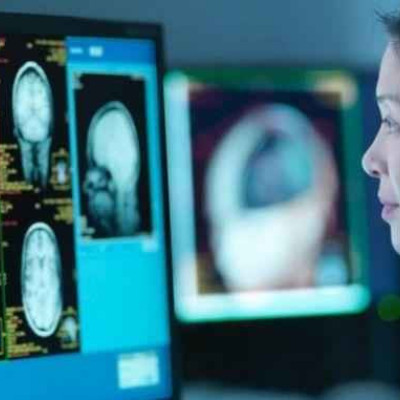 Για πρώτη φορά, επιστήμονες κατέγραψαν τι συμβαίνει στον εγκέφαλο όταν πεθαίνουμε – Τα ευρήματα εντυπωσιάζουν!