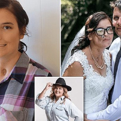 Ο καρκίνος της πήρε το μισό πρόσωπο αλλά εκείνη παντρεύτηκε τον αγαπημένο της έστω κι αν της απομένει 1 χρόνος ζωής