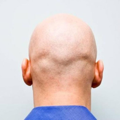 Γιατί χάνουμε τα μαλλιά μας περισσότερο μέσα στις γιορτές των Χριστουγέννων;