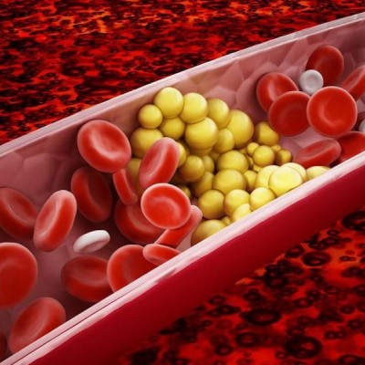 Το πρώτο βήμα για χαμηλότερη χοληστερίνη: Τι προτείνουν οι καρδιολόγοι