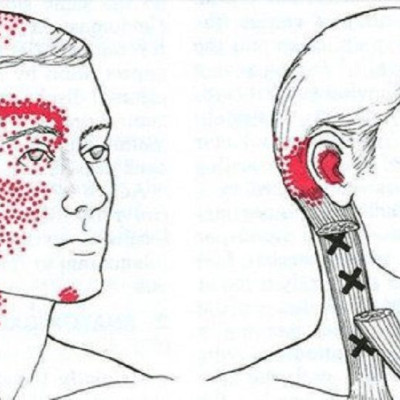 Πονοκέφαλος: Σε ποια σημεία να κάνετε μασάζ για να σας περάσει