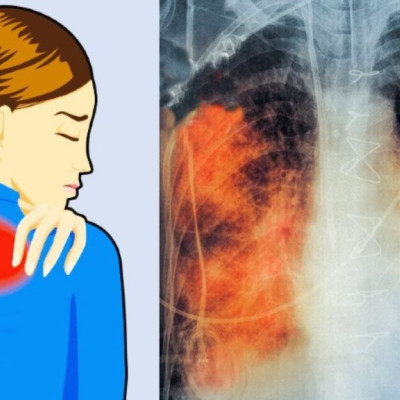 5 πόνοι στο σώμα που δεν πρέπει ποτέ να αγνοήσεις, τι σημαίνουν για την υγεία σου και τι πρέπει να κάνεις